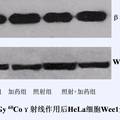 青蒿素对人宫颈癌HeLa细胞辐射增敏作用的研究