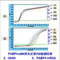 枸杞多糖对THP-1单核细胞源性巨噬细胞内质网应激的影响