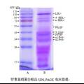 鸡蛋黄中高磷蛋白制备工艺条件的研究