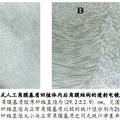 植入式人工角膜基质及其制备方法