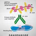 常用化疗方案对原代乳癌细胞抑制率与基因过表达的相关性研究