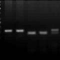 环氧化酶-2基因多态性与2型糖尿病的相关性研究