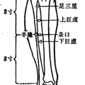 温针灸减低阿司匹林抗风湿剂量引起胃肠道副作用的研发方案