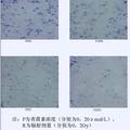 青蒿素对人宫颈癌HeLa细胞辐射增敏作用的研究