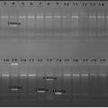 PCR-SSP法检测29种HLA-B27亚型