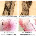 新型磁性纳米载体跨血脊髓屏障靶向定位的实验研究